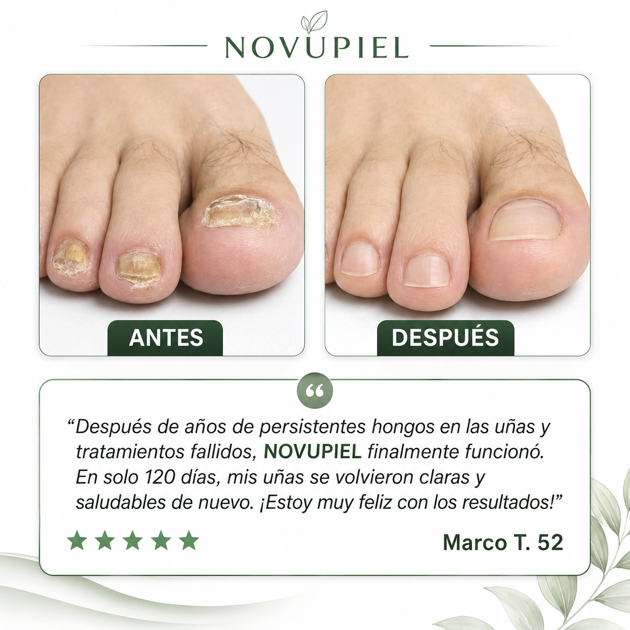 Aceite Reparador de Uña · Resultados visibles en 7 días